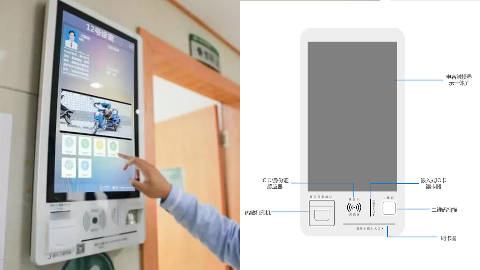 派勤電子AD742A工控主板 | 醫(yī)療設備領域的智能化解決方案